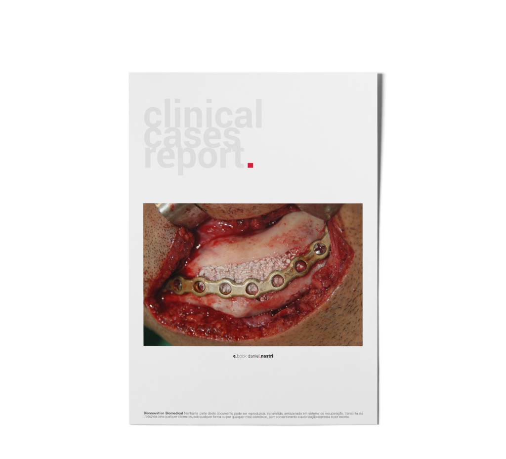 ebook nastri