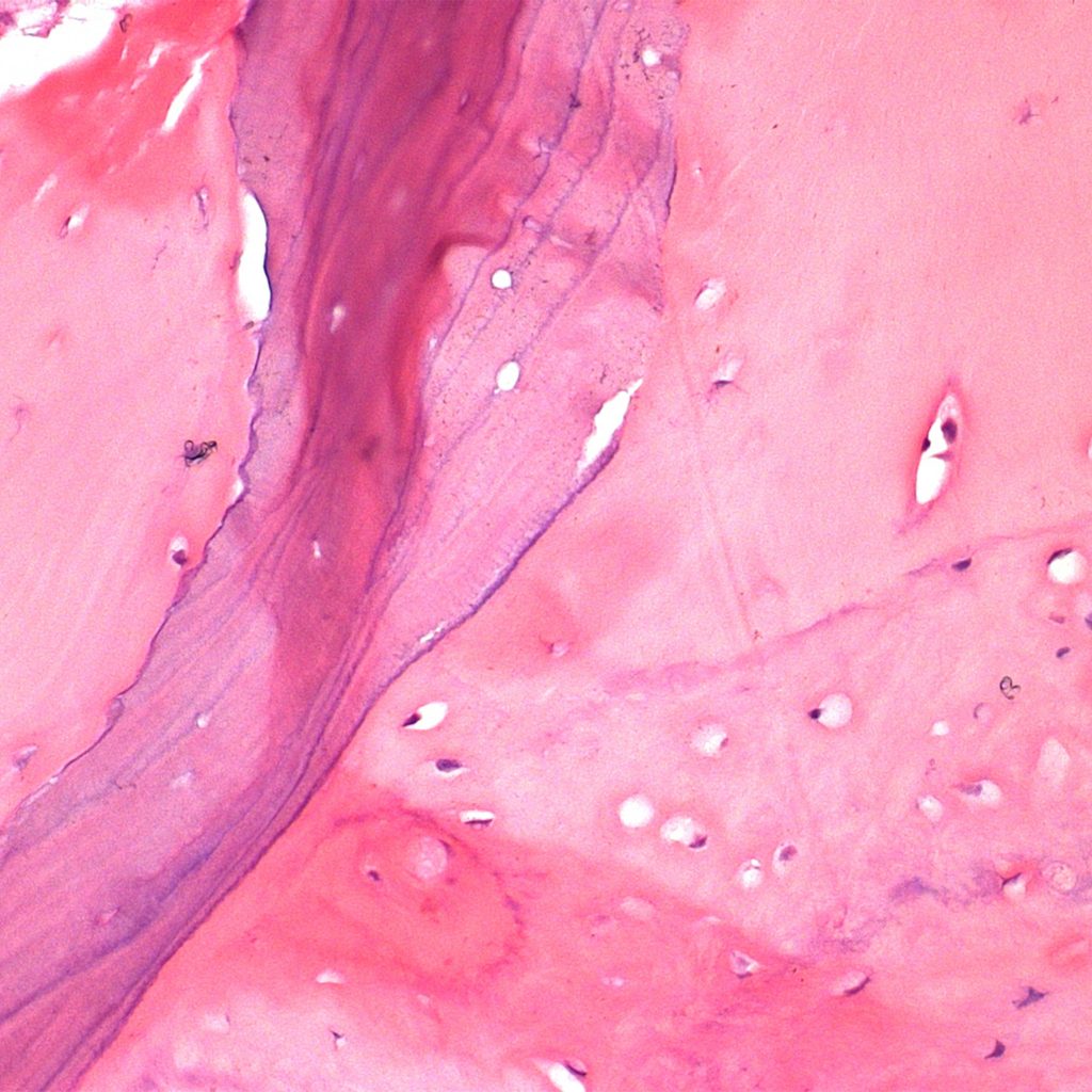 _ENG Bonefill 2 histologico 1s