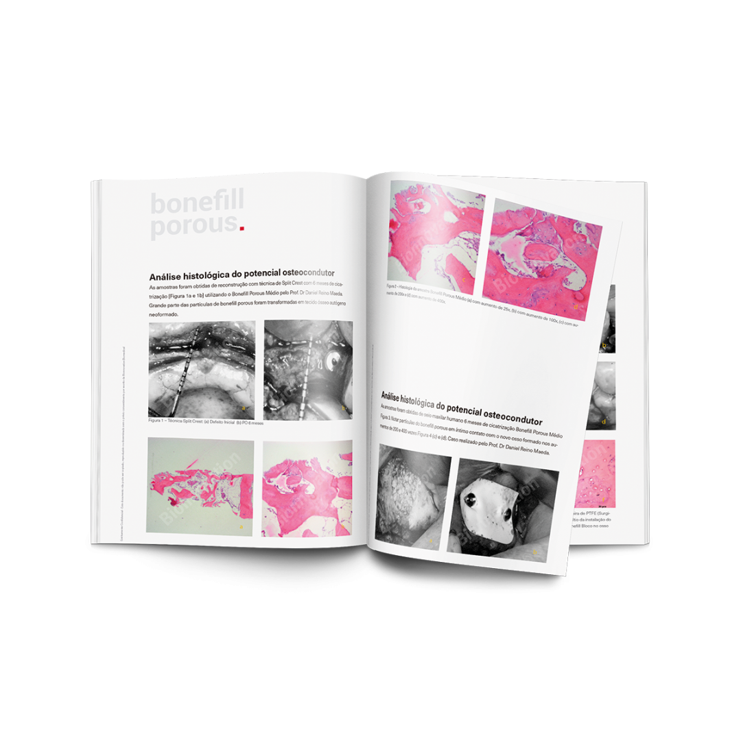 MOCKUP_1 hist