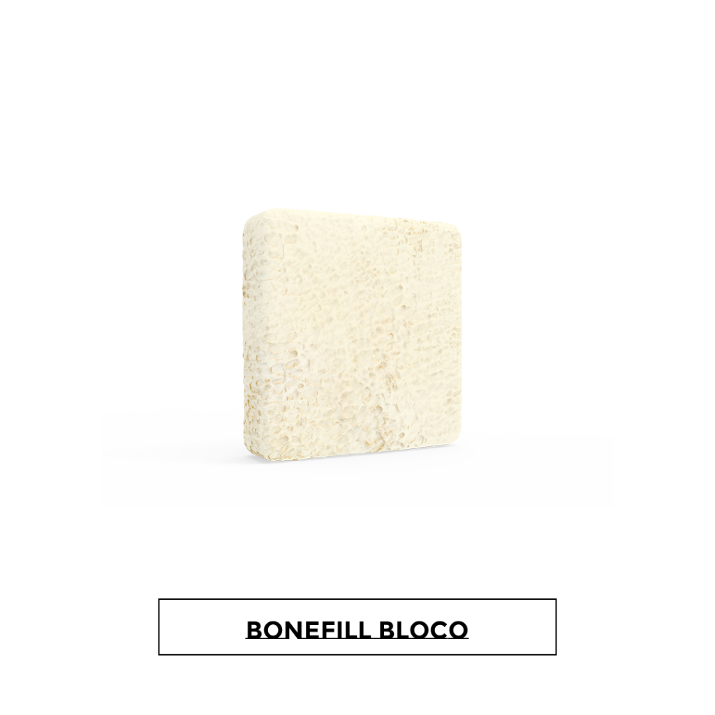 Bonefill Bloco 1