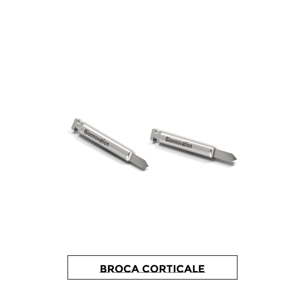 Broca Corticale