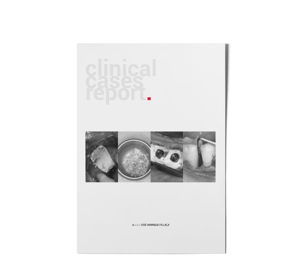 ebook Villaca