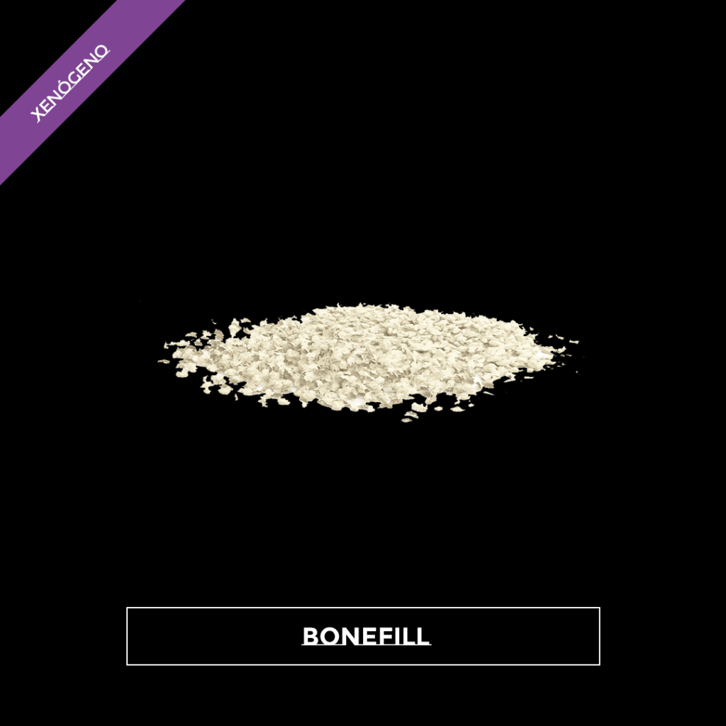 Bonefill