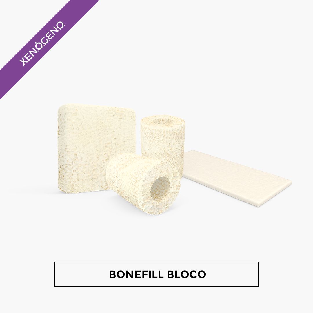 Bonefill Bloco 1